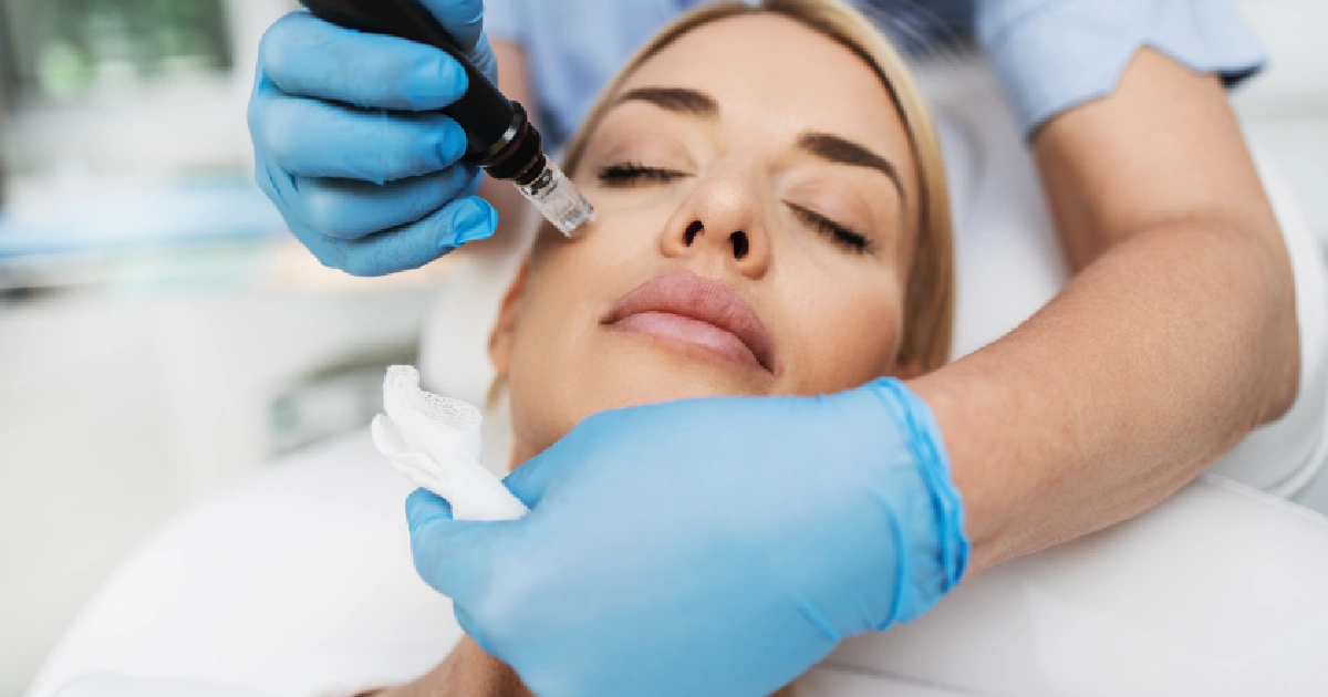 Woman receiving Microneedling treatment